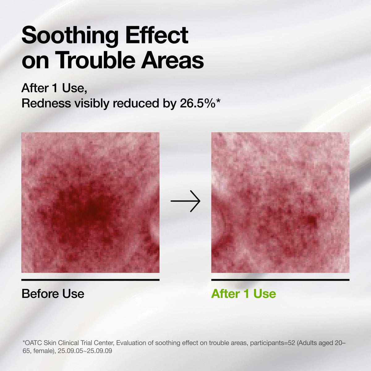 Azelaic Acid CICA Skin Soothing Moisturizer