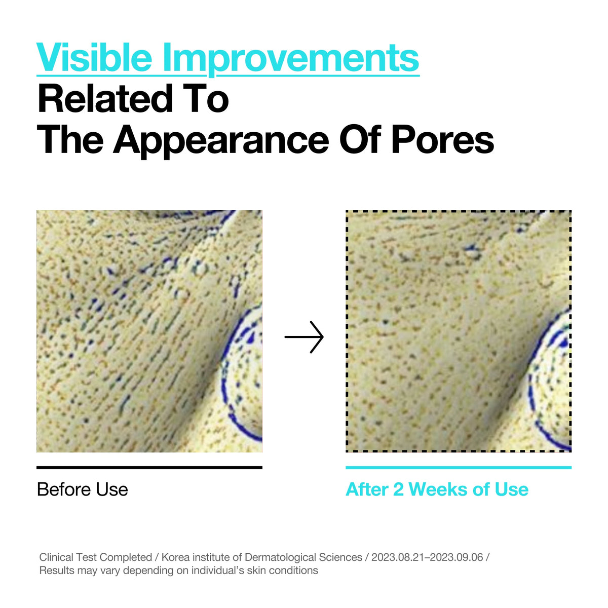Even tone & Pore Refining Duo